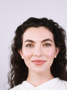 gesicht-v-shape-filler-hyaluron-juvederm-cultureandcream-blogpost