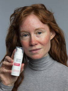 rosacea-skinproblem-roetungen-hauterkrankung-frau-woman-face-cream-gladskin-cultureandcream-blogpost