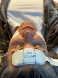 face-applikator-emface-forehead-muscle-toning-radiofrequency-cultureandcream-blogpost
